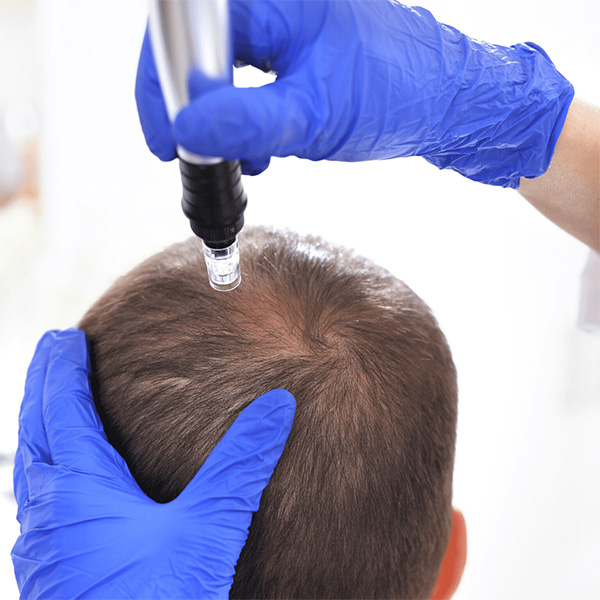 Hair Treatments – Hair Plasis